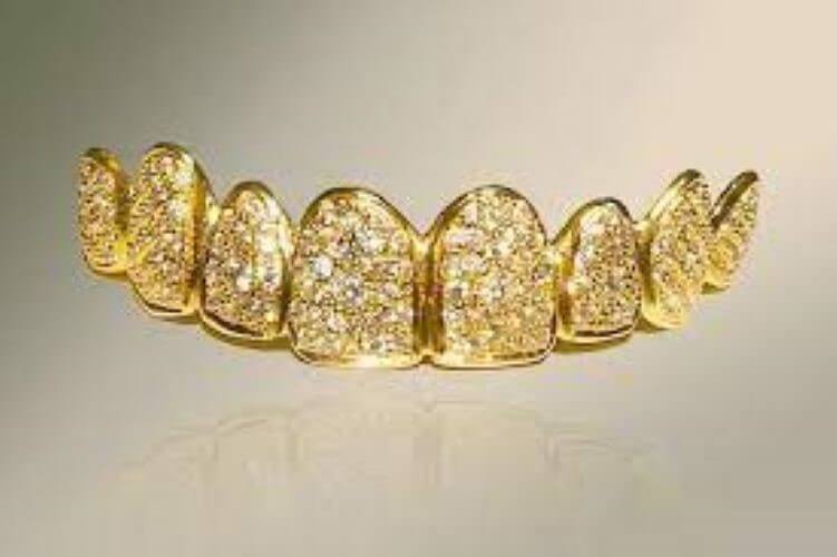¿Cómo quitar el oro de una dentadura?